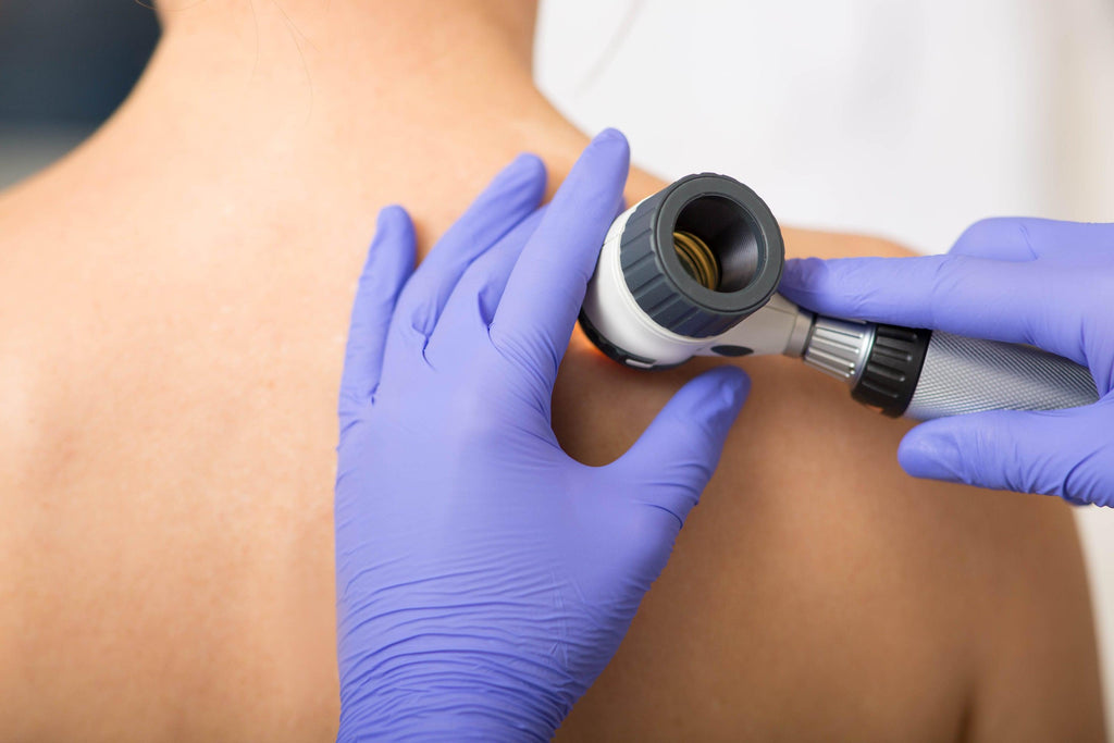 KenetMD Skin Care Journal | Are Examinations Necessary to Detect Skin Cancer? We Vote Yes