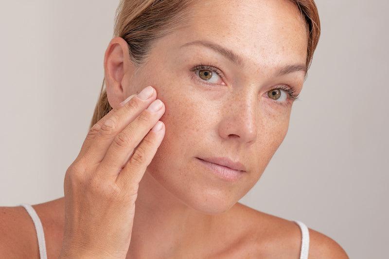 Brown Spots - Kenet MD Skincare